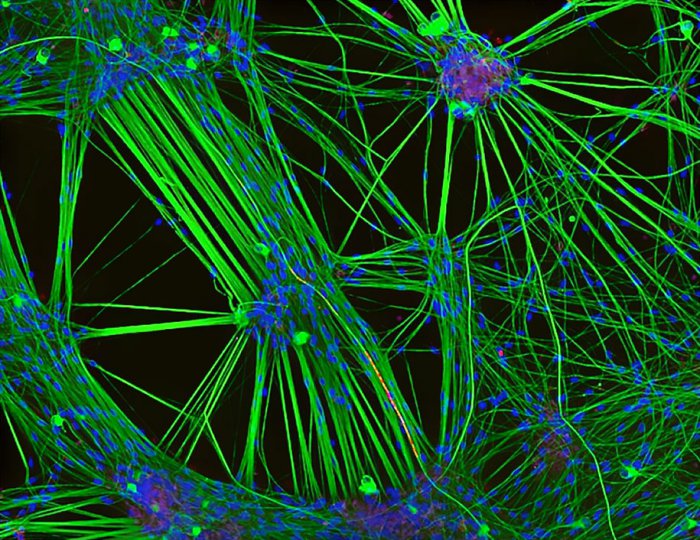 Снимки фотоконкурса «Nikon Small World 2016» (18 фото) Интересные микро снимки живой природы (18 фото)