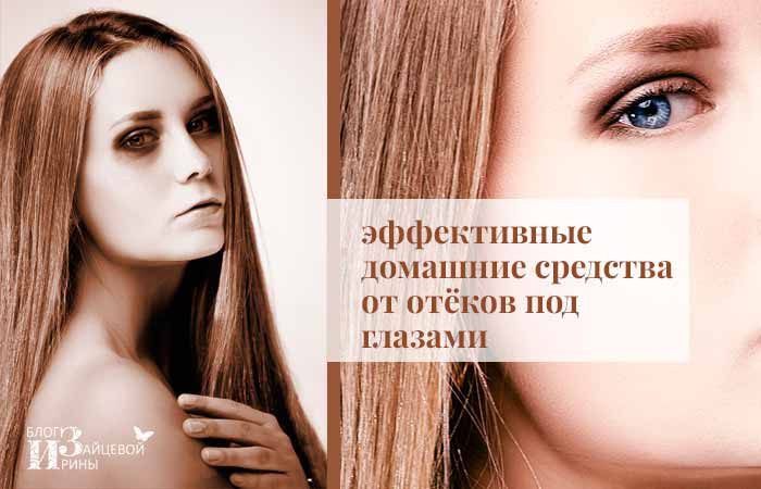 Снять мешки под глазами в домашних условиях