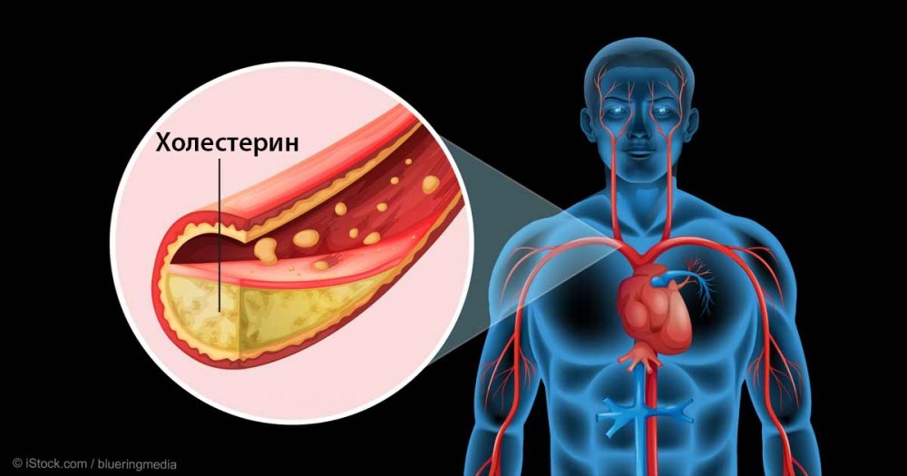 5 фруктов для снижения холестерина 5 фруктов для снижения холестерина