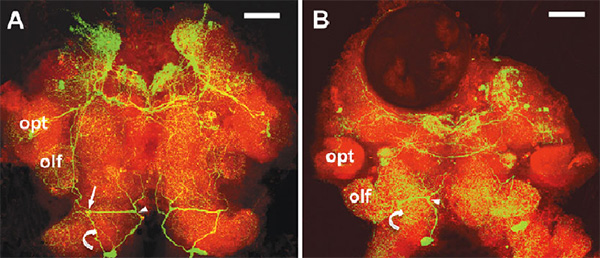 Рис. 2. Распределение серотонина (прокрашен зеленым) в мозге здорового (слева) и зомбированного (справа) скребнем (колючеголовым червем) бокоплава гаммаруса
