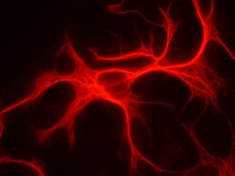 Астроцит в клеточной культуре. Фото GrzegorzWicher