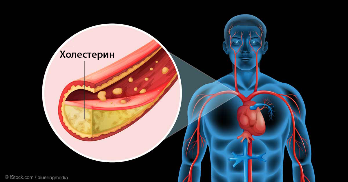 Вот как очистить сосуды от холестерина за 40 дней без единого лекарства