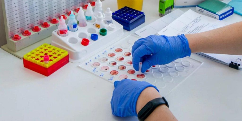 Свыше 50 тыс медработников в Москве прошли тест на иммунитет к COVID-19