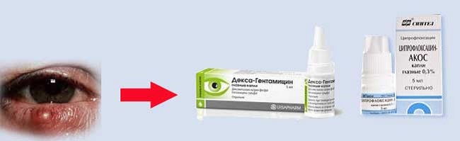 Первая помощь при ячмене Народные средства против ячменя