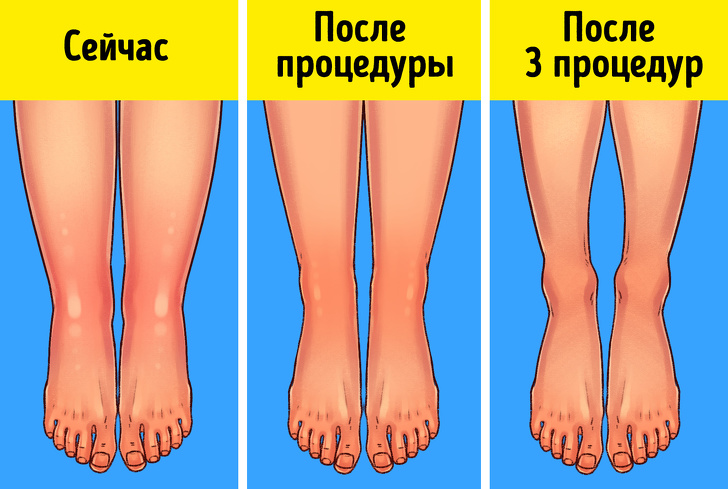 10+ способов использования обычной соды, о которых мало кто знает