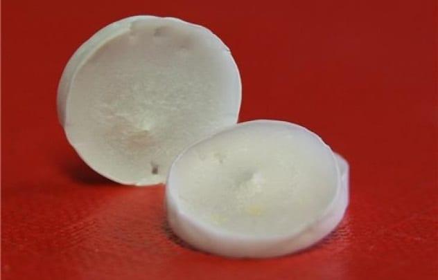 Фотография: Не для слабонервных: 10 жутких медицинских процедур, которые действительно помогают №5 - BigPicture.ru