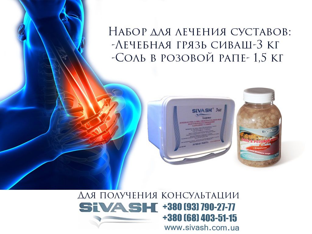 Медицинское лечение артроза суставов Медицинское лечение артроза суставов