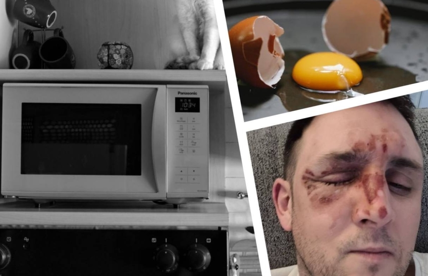 Мужчина хотел приготовить яйцо в микроволновке, но уже через мгновение оказался в больнице