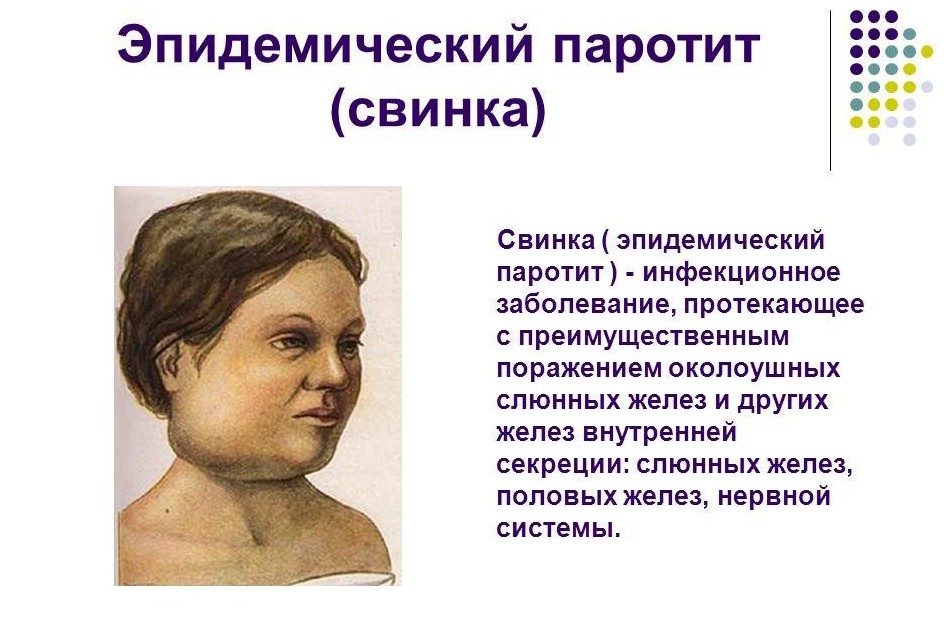 Детские болезни, опасные для взрослых Детские болезни, опасные для взрослых