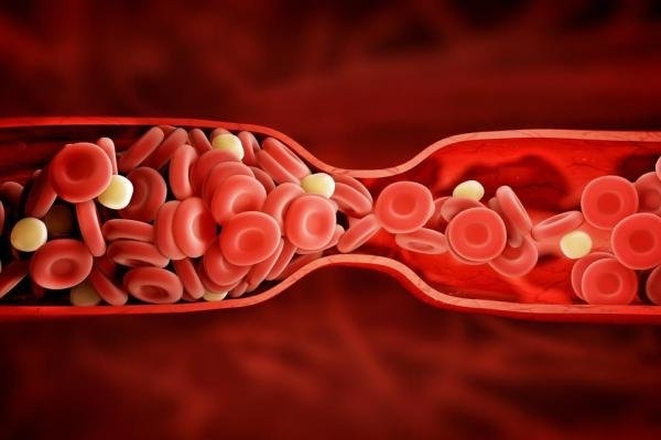 Картинки по запросу blood clot