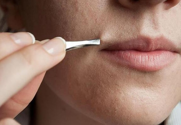 Обесцветить усики над губой в домашних условиях Обесцветить усики над губой в домашних условиях