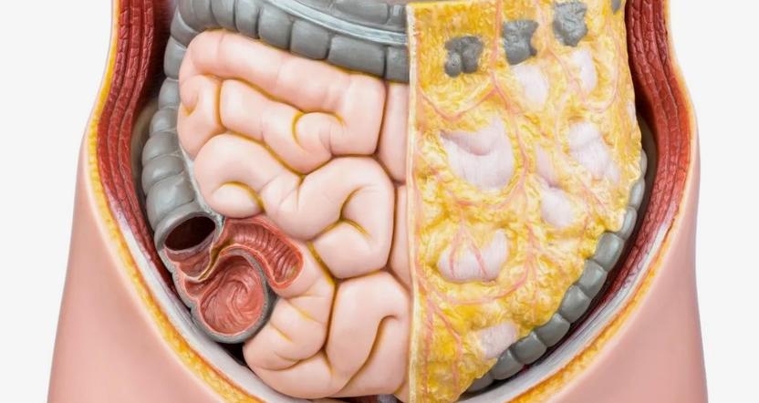 CM: скрытый жир внутри живота и печени может повредить артерии