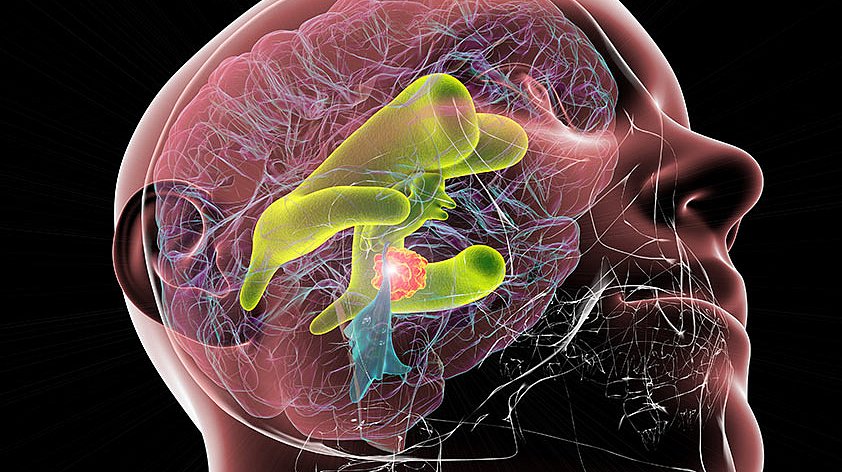 Зевание оказывает неожиданное влияние на жидкость внутри головного мозга