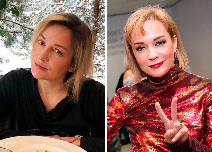 Татьяна буланова до и после пластики сравнение фото