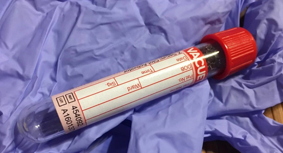 NatMed: основной причиной смерти от рака могут быть не метастазы