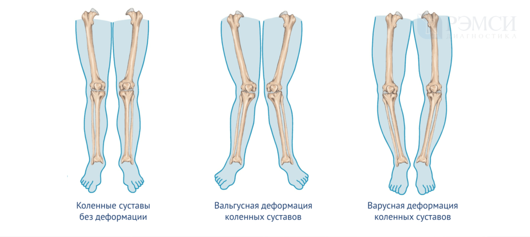 Взято из открытых источников.