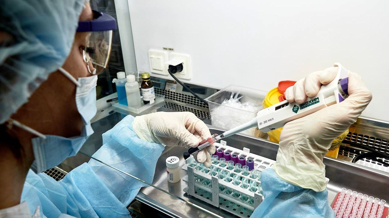 Специалисты объяснили, зачем нужно знать свой ВИЧ-статус и проходить тест