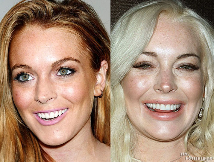 Рисунок: /stars/aging/signs/12lindsay-lohan111.jpg