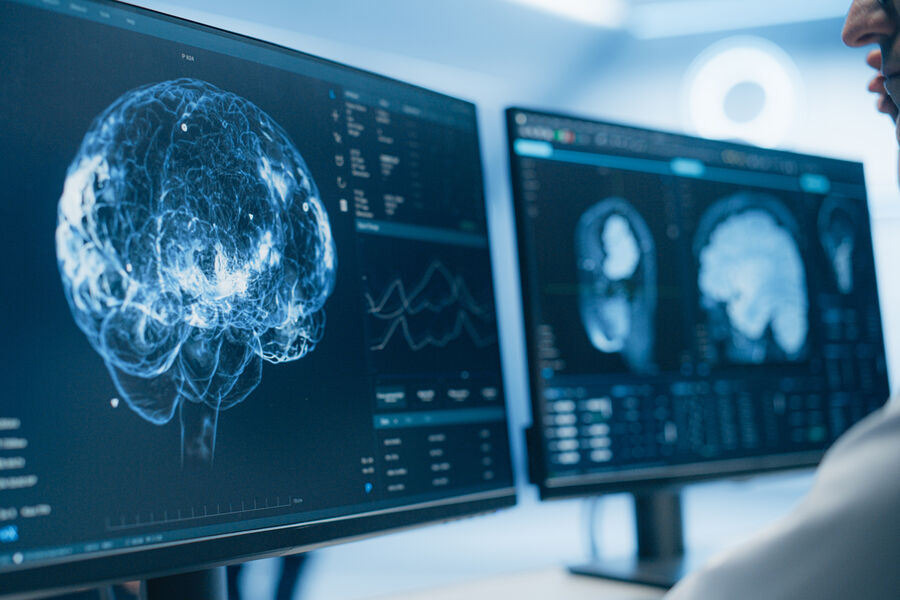 Судмедэксперт Решетун: хорошее снабжение мозга кислородом – залог его здоровья