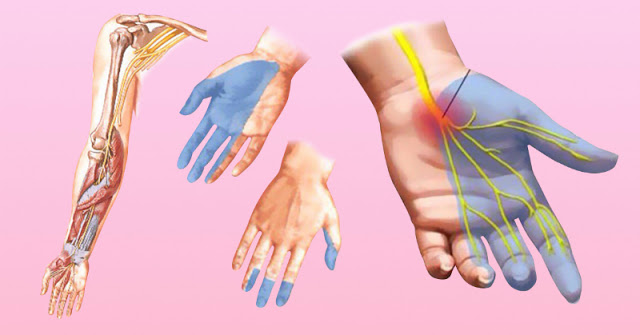 Онемение рук: причины, почему немеют руки, это опасные симптомы!