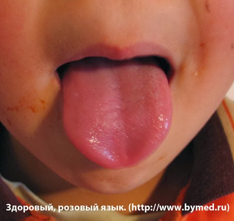 Здоровый, розовый язык