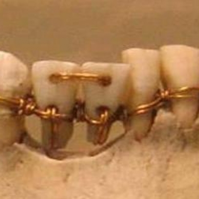 http://2damnfunny.com/wp-content/uploads/2014/03/You-Thought-Going-To-The-Dentist-Today-Was-a-Pain-Go-Back-To-Ancient-Egypt-Try-It-Out_408x408.jpg