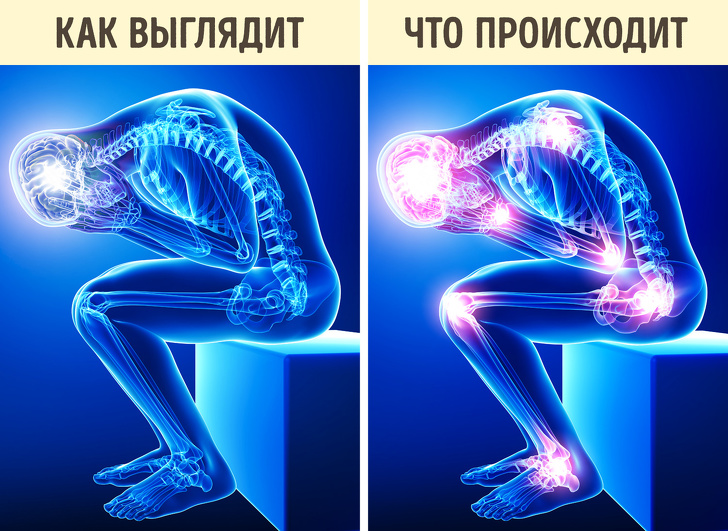 Правила приема обезболивающих, о которых нужно узнать до того, как у вас что-то заболит