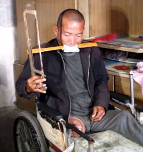 Уставший от боли китаец отпилил себе ногу
