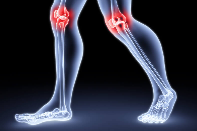 Как избавиться от боли в коленях и локтях