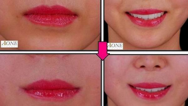 Что теперь сможет сделать с вашим телом пластический хирург: 5 невероятных новых операций Что теперь сможет сделать с вашим телом пластический хирург: 5 невероятных новых операций