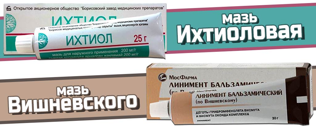 Забытый рецепт волшебной мази от варикозного расширения вен Забытый рецепт волшебной мази от варикозного расширения вен