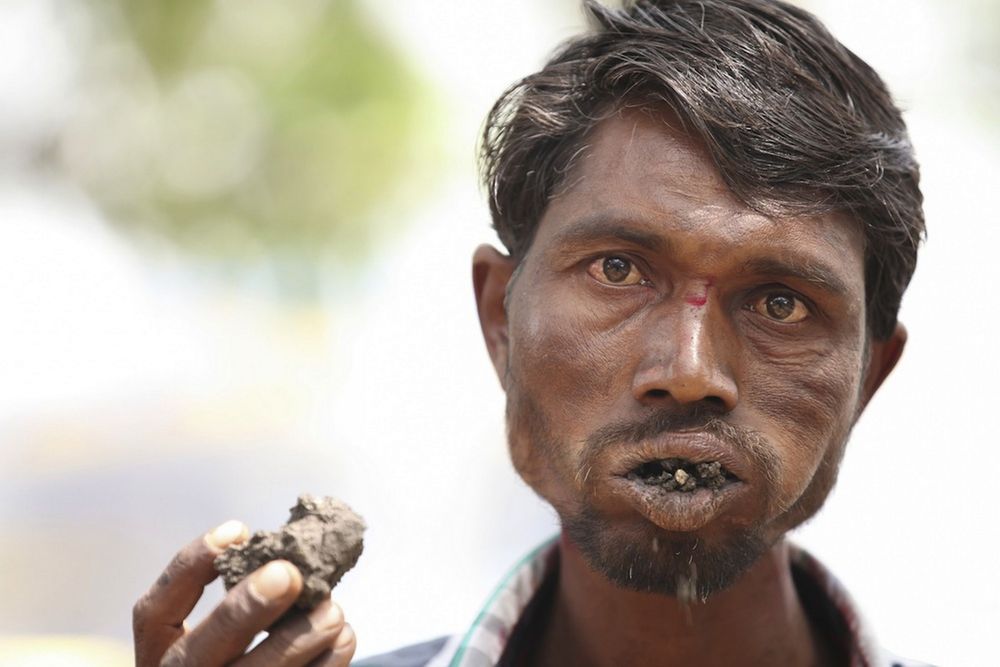 Фотография: 10 странных медицинских состояний, о которых практически никто не слышал №2 - BigPicture.ru