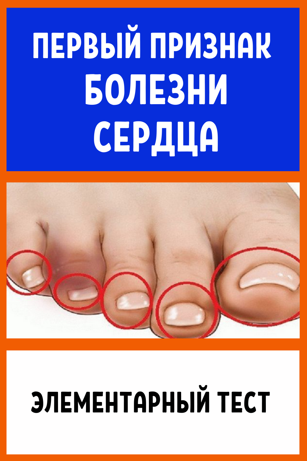 Первый признак болезни сердца
