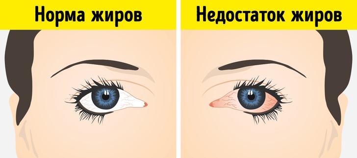 8 неочевидных признаков того, что организму позарез нужны жиры 8 неочевидных признаков того, что организму позарез нужны жиры