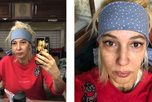 «После родов потеряла красоту»: Лера Кудрявцева неприятно удивила поклонников фото без макияжа «После родов потеряла красоту»: Лера Кудрявцева неприятно удивила поклонников фото без макияжа