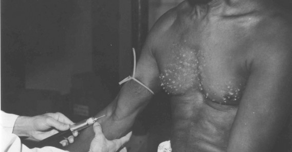 Эксперимент Таскиги Конспирология, странно и страшно, теория заговора