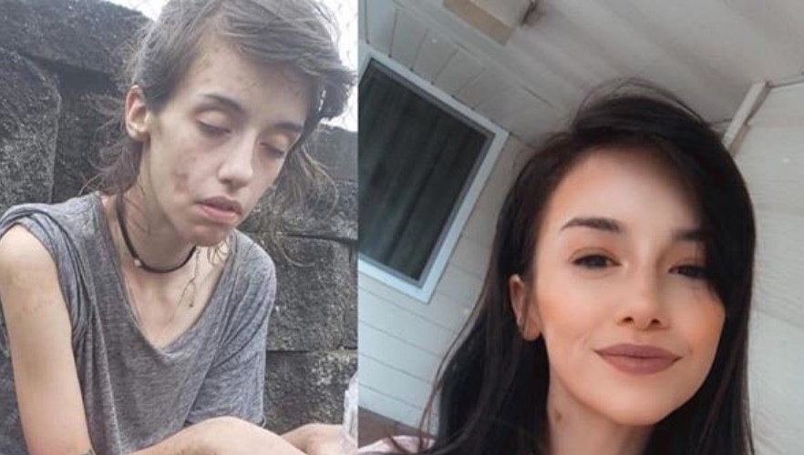 20 фото людей «до и после» того, как им удалось справиться с зависимостью