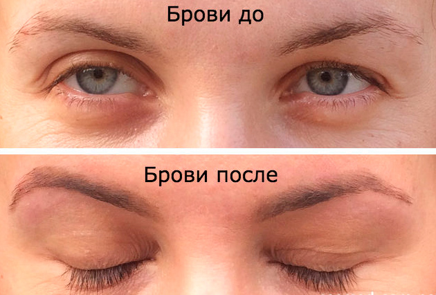 Касторовое масло для бровей результаты Касторовое масло для бровей результаты