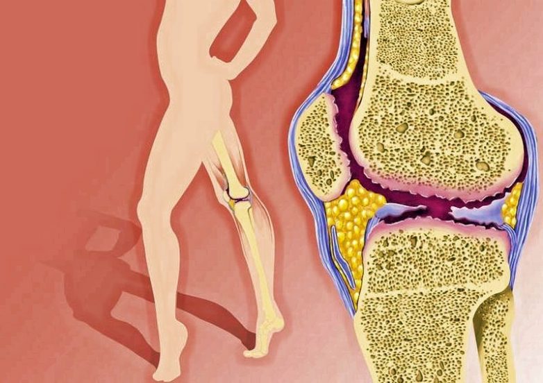 Продукты, которые убивают наши суставы