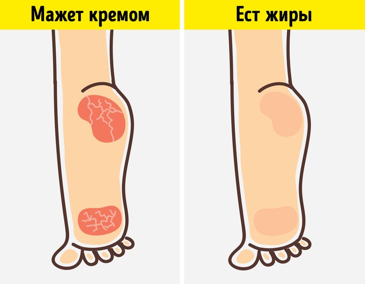 8 неочевидных признаков того, что организму позарез нужны жиры 8 неочевидных признаков того, что организму позарез нужны жиры