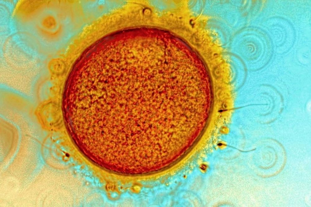 9 кислотных фото цветов, животных и других вещей под микроскопом
