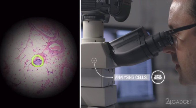 Google доработала микроскоп для выявления онкологии