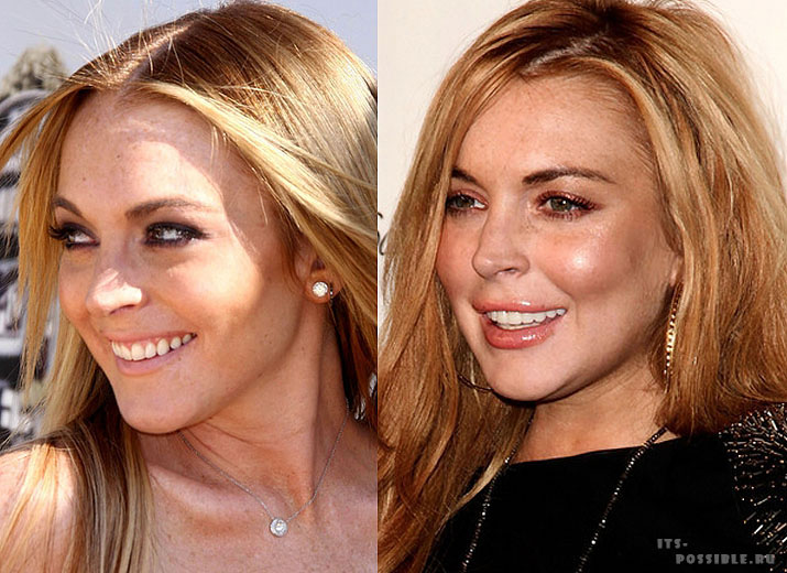 Рисунок: /stars/aging/signs/11lindsay-lohan1.jpg