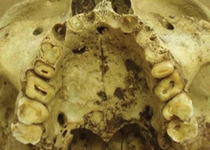 Серьезные проблемы с зубами. Серьезные проблемы с зубами.