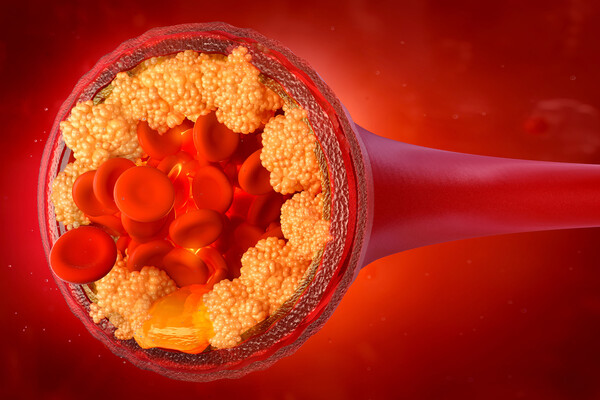 Langmuir: фермент, ответственный за повышение холестерина можно «отключить»