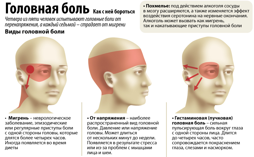 Болит правая часть головы почему Болит правая часть головы почему