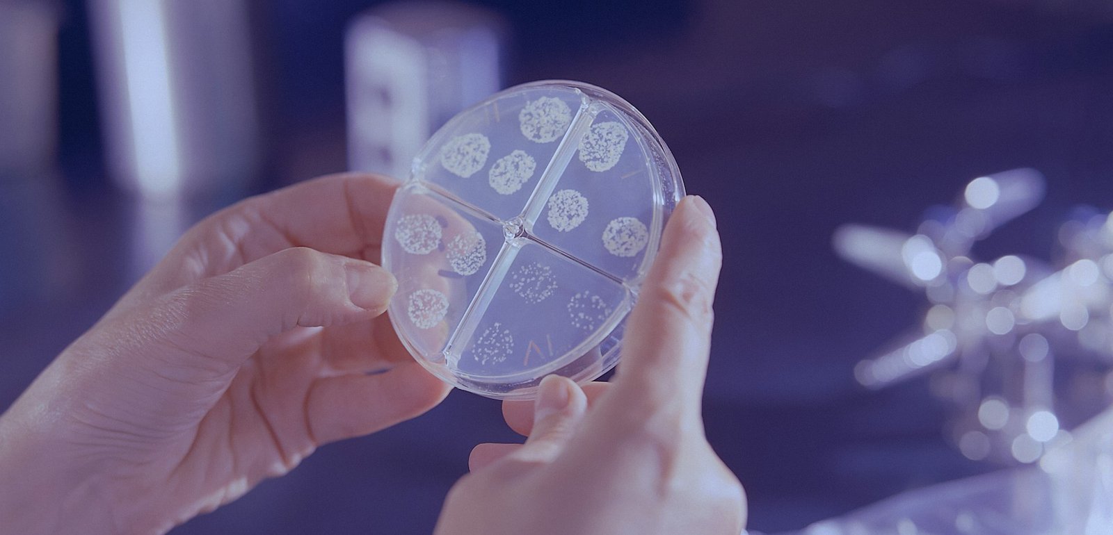 ПНИПУ: найдено слабое место супермикробов