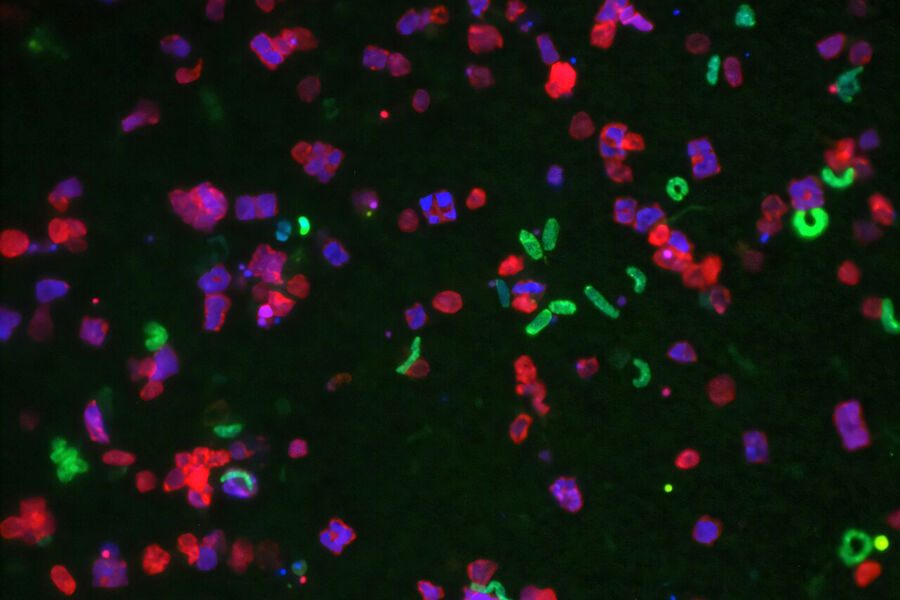В России нашли способ снизить побочные эффекты химиотерапии