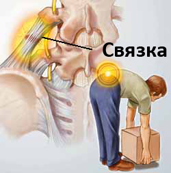 Боль в спине — как лечиться, чтоб не разориться Боль в спине — как лечиться, чтоб не разориться