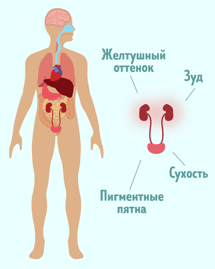 9 неочевидных симптомов, которые говорят о том, что с почками что-то не в порядке